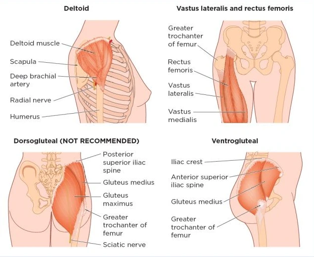 Intramuscular injection sites