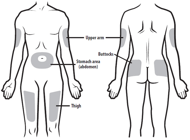 Subcutaneous injection sites from Pfizer labeling site