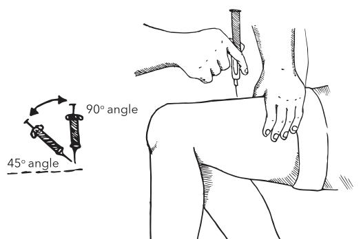 Subcutaneous injecting angles